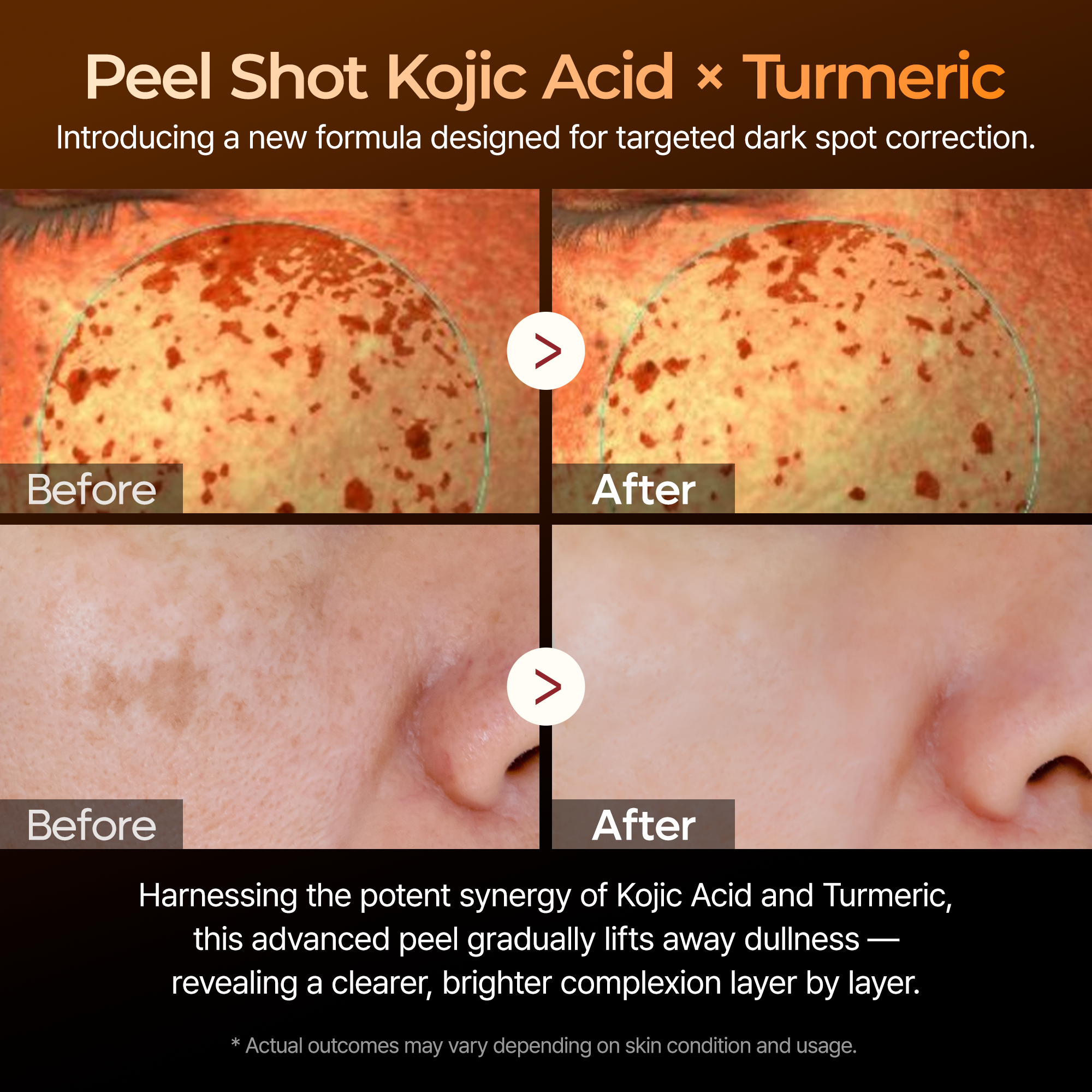 [Dr. Melaxin] Peel Shot Kojic Acid Turmeric Serum (80m) 96ea/box