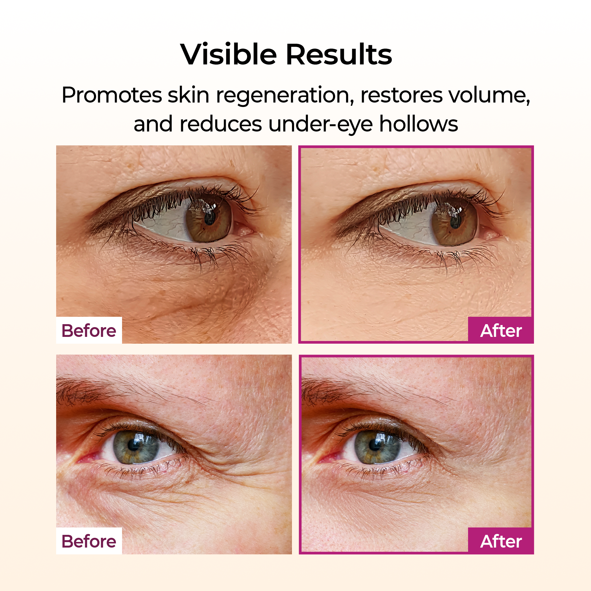 [Dr. Melaxin] Cemenrete Calcium Volume Multi Balm_9g  56ea/box