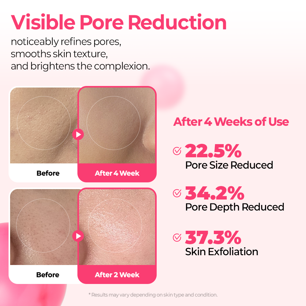 [Dr. Melaxin] Cemenrete Cyano Pink Spicule Serum (30ml)  104ea/box