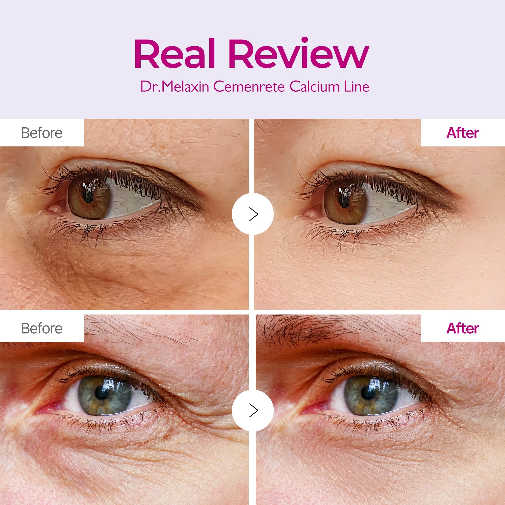 [Dr. Melaxin] Cemenrete Calcium Volume Eye patch (60ea) 54ea/box