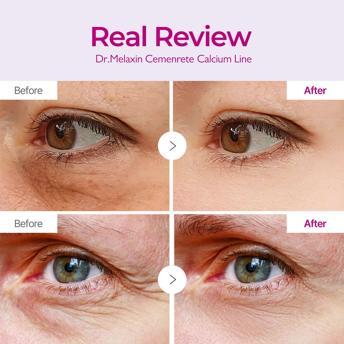 [Dr. Melaxin] Cemenrete Calcium Volume Eye patch (60ea) 54ea/box