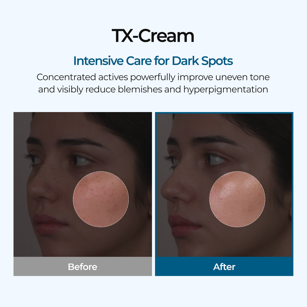 [Dr. Melaxin] TX Cream (50ml)   98ea/box