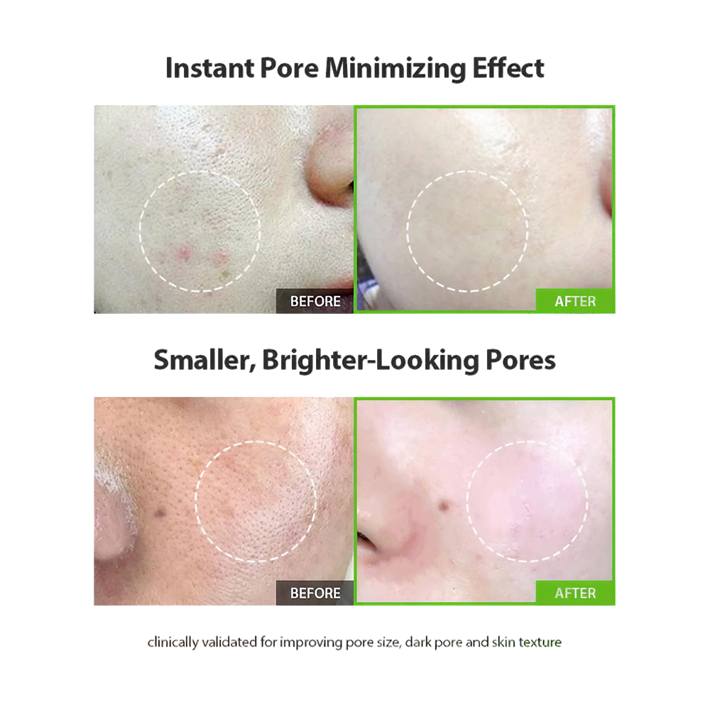[Sungboon Editor] Green Tomato Pore Minimizing Ampoule Plus (30ml) 72ea/box