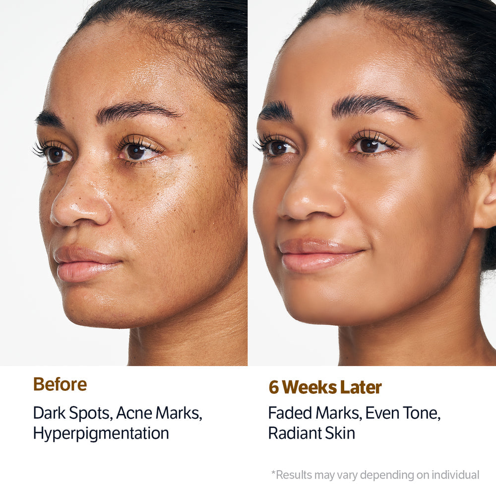[Sungboon Editor] Kojic Acid Niacinamide Radiance Soothing Gel Cleanser (120g) 30ea/box